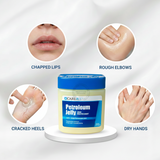 CareALL 4 oz. Tub of Petroleum Jelly (NBE Vaseline)